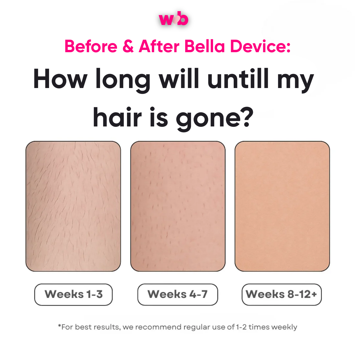 Bella IPL Hair Remover™ | UK's #1 at-home laser hair removal
